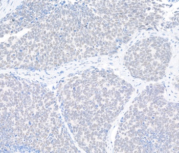 Rabbit anti-SKIV2L2 Antibody