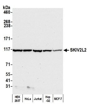 Rabbit anti-SKIV2L2 Antibody