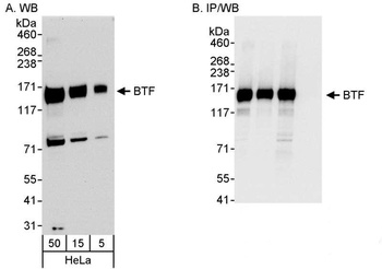 BTF Antibody