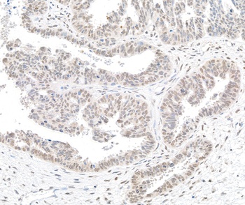 Rabbit anti-BTF Antibody
