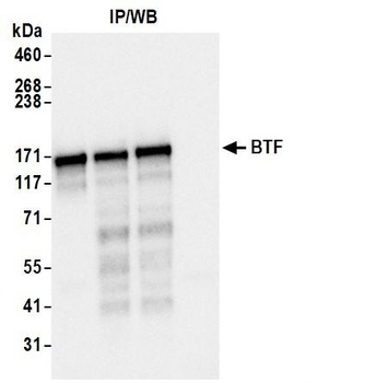 BTF Antibody