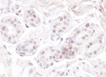 Rabbit anti-GNL3 Antibody