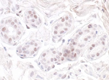 GNL3 Antibody