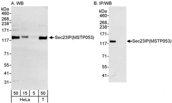 Rabbit anti-Sec23IP/MSTP053 Antibody