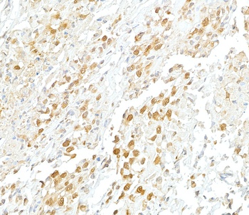 VCP Antibody