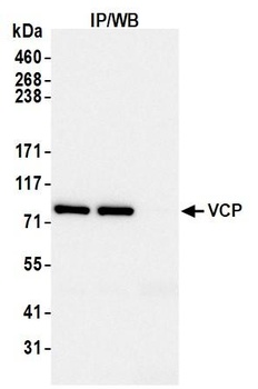 VCP Antibody