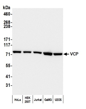 Rabbit anti-VCP Antibody