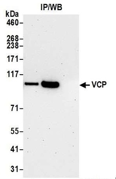 Rabbit anti-VCP Antibody