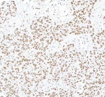 Rabbit anti-NONO Antibody
