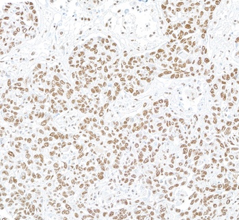 NONO Antibody