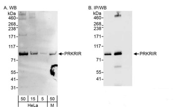 PRKRIR Antibody