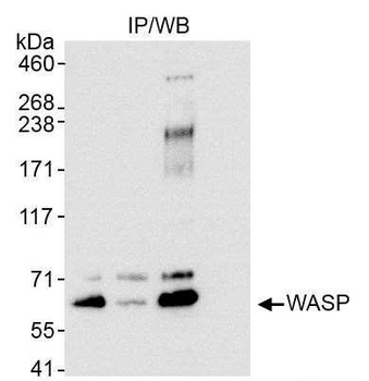 Rabbit WASP Antibody