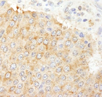Rabbit NF2 Antibody