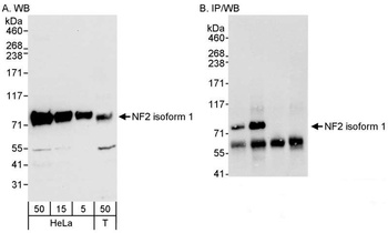 Rabbit NF2 Antibody