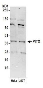 Rabbit PITX1 Antibody