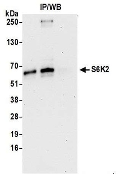 Rabbit S6K2 Antibody