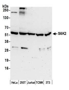 Rabbit S6K2 Antibody