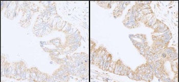 Rabbit anti-INPPL1/SHIP2 Antibody