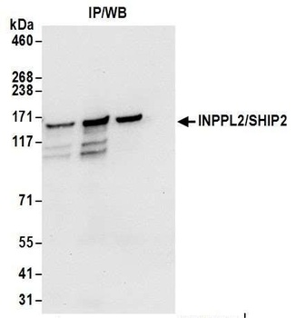 INPPL1/SHIP2 Antibody