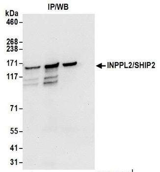 Rabbit anti-INPPL1/SHIP2 Antibody