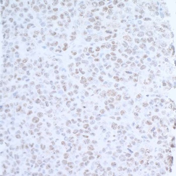 Rabbit anti-EDD1 Antibody