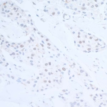Rabbit anti-EDD1 Antibody