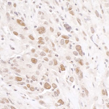 Rabbit anti-RIF1 Antibody