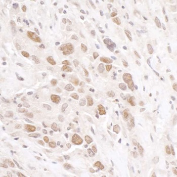 RIF1 Antibody