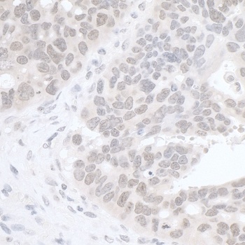 Rabbit anti-RIF1 Antibody