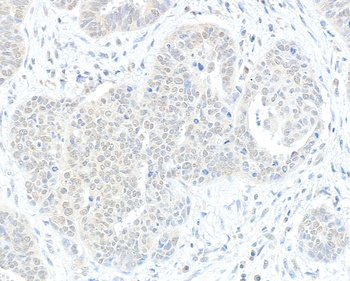 Rabbit anti-RIF1 Antibody