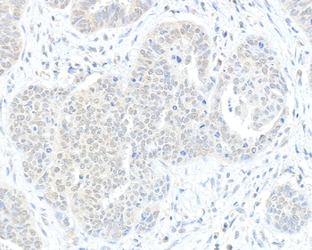 RIF1 Antibody