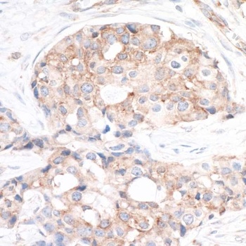 Rabbit RPS6 Antibody