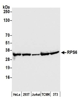 Rabbit RPS6 Antibody