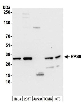 Rabbit RPS6 Antibody