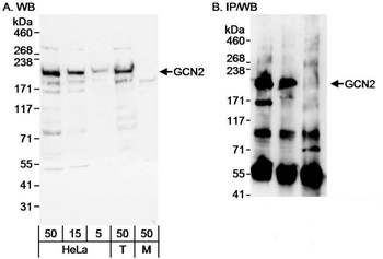 Rabbit GCN2 Antibody