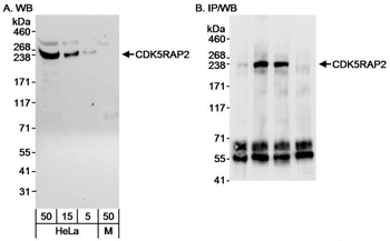 Rabbit anti-CDK5RAP2 Antibody