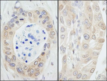 Rabbit anti-NMI Antibody