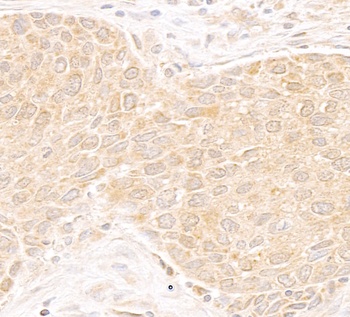 Rabbit anti-DDX19 Antibody