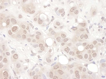 Rabbit anti-REST Antibody