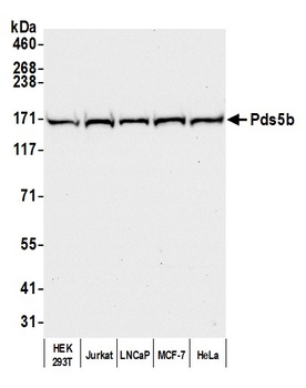 Rabbit anti-Pds5B Antibody