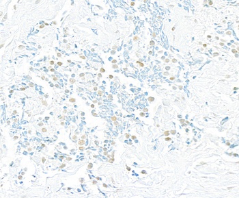 Rabbit anti-Pds5B Antibody