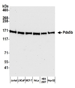 Rabbit anti-Pds5B Antibody