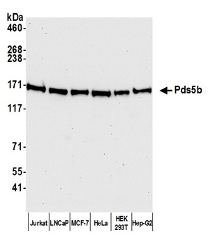 Pds5B Antibody