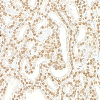 Rabbit anti-Pds5B Antibody