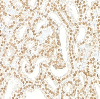 Pds5B Antibody