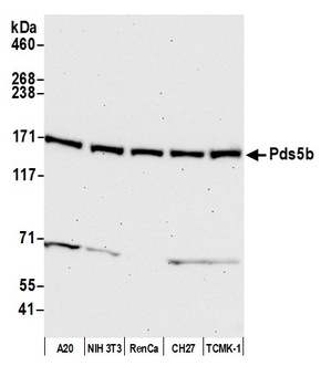 Rabbit anti-Pds5B Antibody