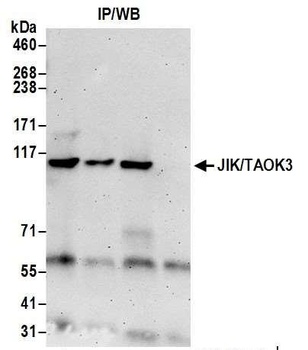 JIK/TAOK3 Antibody