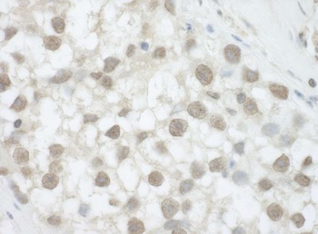 Rabbit anti-DHX36 Antibody