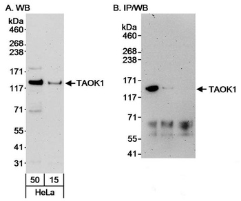 Rabbit TAOK1 Antibody