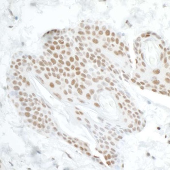 Rabbit anti-DDX5 Antibody